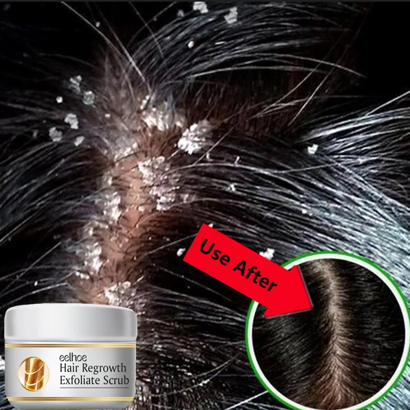 Fast Anti Dandruff Hair Treatm - Scalp Scrub Exfoliant 评论和价格