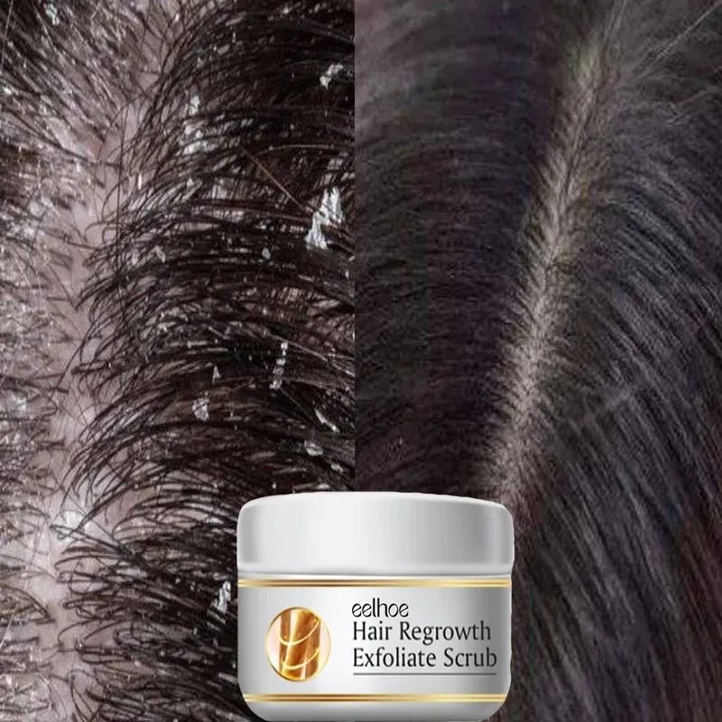 Fast Anti Dandruff Hair Treatm - Scalp Scrub Exfoliant 评论和价格