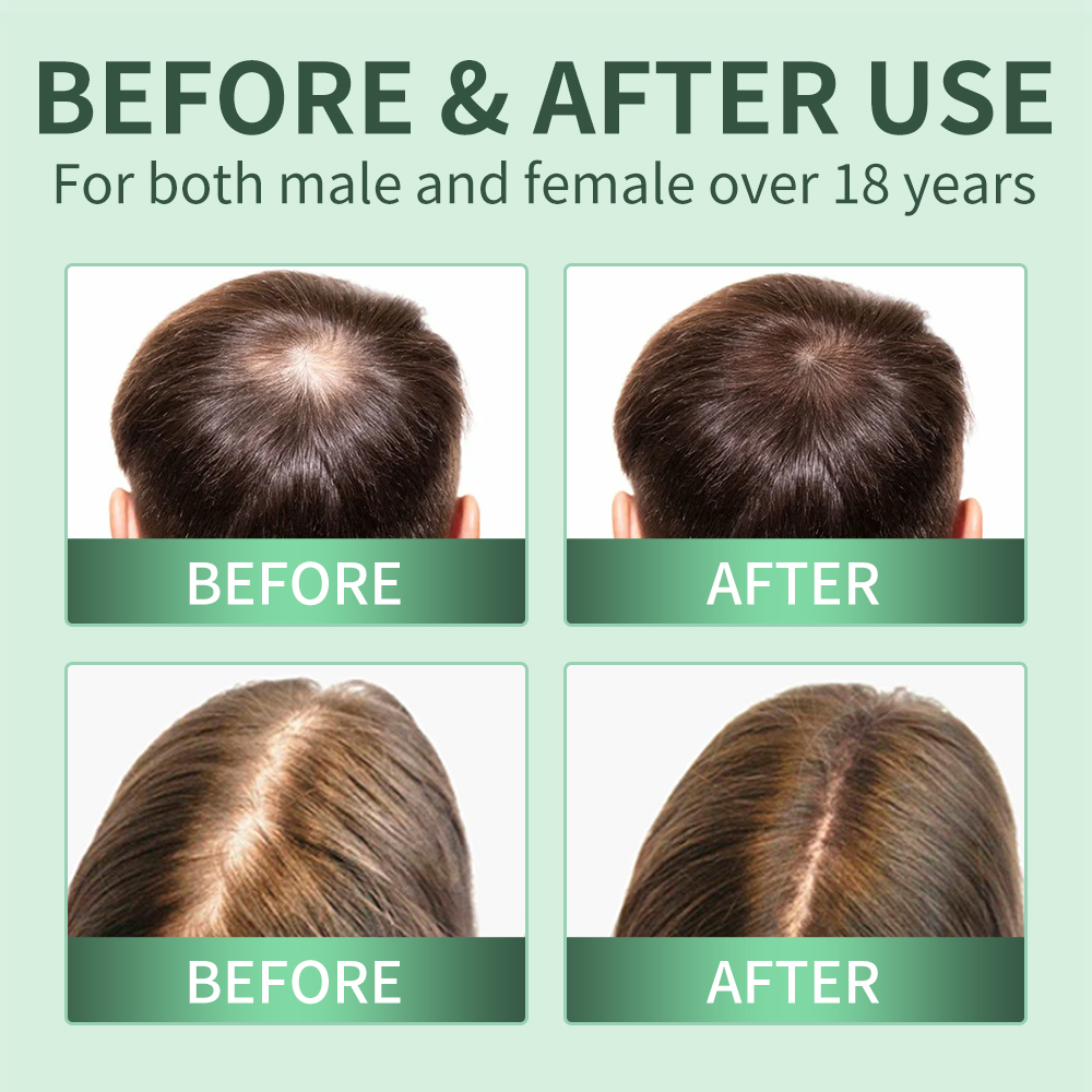 Hair Growth Spray,Scalp Scrub, - Scalp Scrub Exfoliant 评论和价格