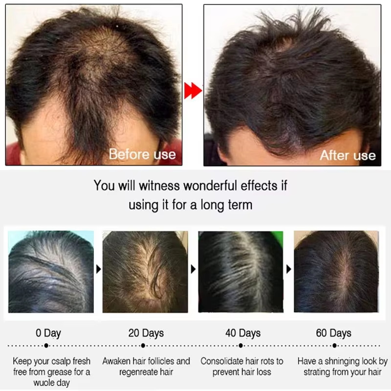 Fast Ginger Hair Growth Spray  - Hair Care Naturally 评论和价格